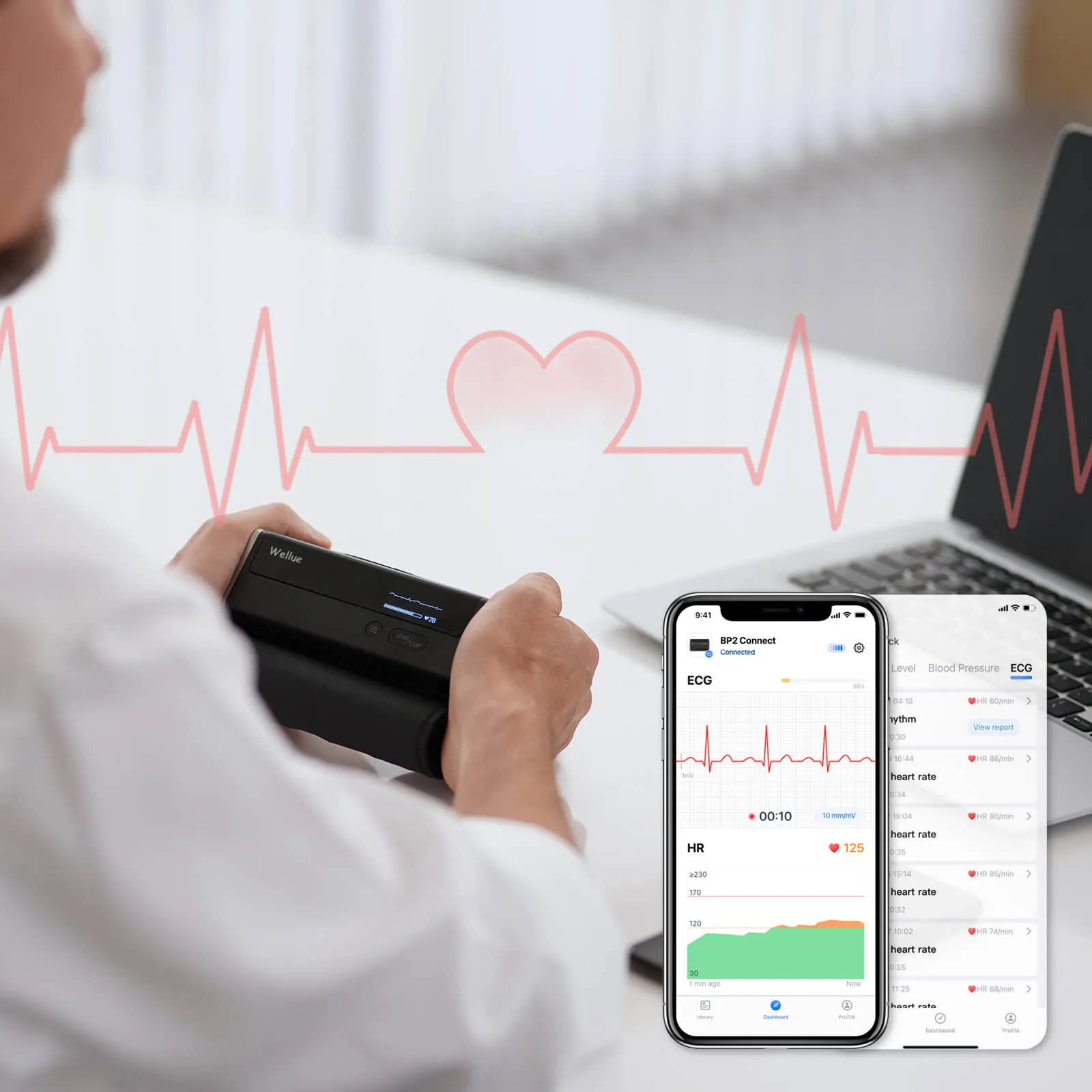 Wi-Fi Blood Pressure Monitor with ECG